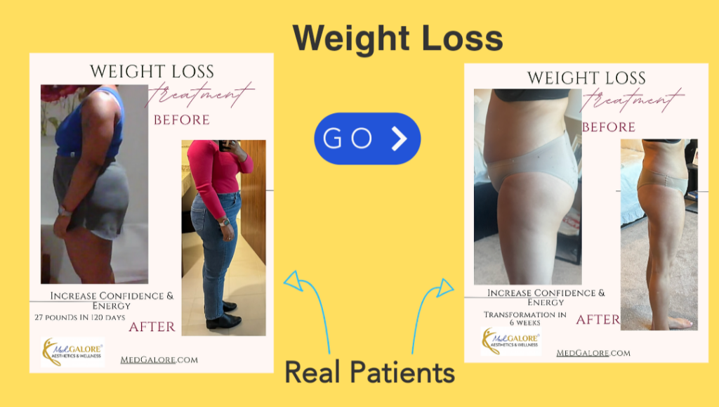 MedGalore Weight Loss successful plan with latest medication